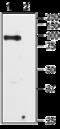 Transient Receptor Potential Cation Channel Subfamily V Member 6 antibody, GTX54869, GeneTex, Western Blot image 