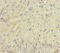 Cereblon antibody, LS-C682099, Lifespan Biosciences, Immunohistochemistry paraffin image 
