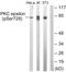 Protein Kinase C Epsilon antibody, LS-C822150, Lifespan Biosciences, Western Blot image 