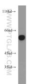 Mitogen-Activated Protein Kinase 7 antibody, 10036-2-AP, Proteintech Group, Western Blot image 