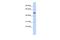 BTB Domain Containing 3 antibody, A15170, Boster Biological Technology, Western Blot image 