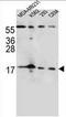 Fibroblast Growth Factor 22 antibody, AP51657PU-N, Origene, Western Blot image 