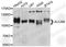 Activated Leukocyte Cell Adhesion Molecule antibody, A2218, ABclonal Technology, Western Blot image 