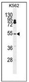 Cleavage And Polyadenylation Specific Factor 7 antibody, AP51061PU-N, Origene, Western Blot image 