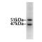 Glycogen Synthase Kinase 3 Alpha antibody, MBS395149, MyBioSource, Western Blot image 