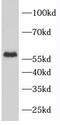 Regulator Of Microtubule Dynamics 3 antibody, FNab06930, FineTest, Western Blot image 