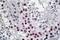TSPY Like 2 antibody, orb20482, Biorbyt, Immunohistochemistry paraffin image 