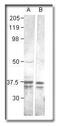 Calcium/Calmodulin Dependent Protein Kinase I antibody, PA1-28252, Invitrogen Antibodies, Western Blot image 