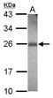 Ras Homolog Family Member F, Filopodia Associated antibody, PA5-31471, Invitrogen Antibodies, Western Blot image 