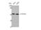 Cytochrome P450 Family 2 Subfamily D Member 6 antibody, STJ92583, St John