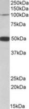 Patched Domain Containing 1 antibody, NBP1-52108, Novus Biologicals, Western Blot image 