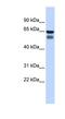 Polypeptide N-Acetylgalactosaminyltransferase 4 antibody, NBP1-62381, Novus Biologicals, Western Blot image 