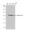 Actinin Alpha 3 (Gene/Pseudogene) antibody, NBP2-15356, Novus Biologicals, Western Blot image 