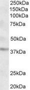 Growth Hormone Inducible Transmembrane Protein antibody, NBP1-52001, Novus Biologicals, Western Blot image 