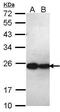 Proteasome Subunit Beta 5 antibody, PA5-28086, Invitrogen Antibodies, Western Blot image 