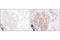 Erb-B2 Receptor Tyrosine Kinase 3 antibody, 2842S, Cell Signaling Technology, Immunohistochemistry paraffin image 
