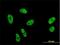 Splicing Factor 1 antibody, H00007536-M01, Novus Biologicals, Immunofluorescence image 