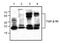 Transforming Growth Factor Beta Receptor 1 antibody, GTX59892, GeneTex, Western Blot image 