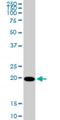 Cytidine/Uridine Monophosphate Kinase 1 antibody, H00051727-M03, Novus Biologicals, Western Blot image 