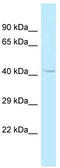 ArfGAP With GTPase Domain, Ankyrin Repeat And PH Domain 1 antibody, TA343187, Origene, Western Blot image 