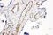 Hyaluronan Mediated Motility Receptor antibody, LS-C312747, Lifespan Biosciences, Immunohistochemistry paraffin image 