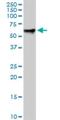 Radixin antibody, H00005962-M01, Novus Biologicals, Western Blot image 