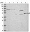Zinc Finger C2HC-Type Containing 1C antibody, NBP2-47462, Novus Biologicals, Western Blot image 