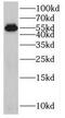 Spermatogenesis Associated 6 antibody, FNab08164, FineTest, Western Blot image 