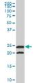 Triosephosphate Isomerase 1 antibody, H00007167-M02A, Novus Biologicals, Western Blot image 