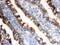Isocitrate Dehydrogenase (NADP(+)) 1, Cytosolic antibody, PB9601, Boster Biological Technology, Immunohistochemistry frozen image 