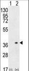 Major Histocompatibility Complex, Class II, DQ Alpha 1 antibody, LS-C164916, Lifespan Biosciences, Western Blot image 