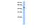 Transmembrane Protein 266 antibody, GTX45676, GeneTex, Western Blot image 