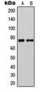 Chloride Voltage-Gated Channel Ka antibody, orb213750, Biorbyt, Western Blot image 