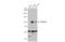 Forkhead Box O3 antibody, GTX100277, GeneTex, Western Blot image 