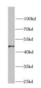 G Protein Subunit Alpha I3 antibody, FNab03533, FineTest, Western Blot image 