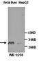 Chloride Intracellular Channel 2 antibody, orb76940, Biorbyt, Western Blot image 