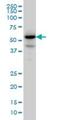 Protein Phosphatase, Mg2+/Mn2+ Dependent 1F antibody, H00009647-M01, Novus Biologicals, Western Blot image 