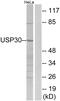 Ubiquitin Specific Peptidase 30 antibody, GTX87959, GeneTex, Western Blot image 