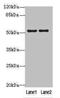 Solute Carrier Family 46 Member 3 antibody, orb33868, Biorbyt, Western Blot image 