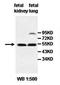 Hyaluronidase 2 antibody, orb77371, Biorbyt, Western Blot image 