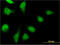 Prefoldin Subunit 2 antibody, LS-C197881, Lifespan Biosciences, Immunofluorescence image 