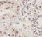 Interferon Regulatory Factor 2 Binding Protein 2 antibody, FNab04388, FineTest, Immunohistochemistry paraffin image 