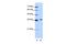 Exosome Component 7 antibody, GTX30775, GeneTex, Western Blot image 