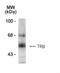 Thyroid Hormone Receptor Beta antibody, NB100-61088, Novus Biologicals, Western Blot image 