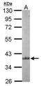 Actin Related Protein 2/3 Complex Subunit 1B antibody, PA5-28103, Invitrogen Antibodies, Western Blot image 