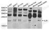 Interleukin 25 antibody, A8252, ABclonal Technology, Western Blot image 