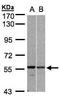 Pre-MRNA Processing Factor 19 antibody, GTX106952, GeneTex, Western Blot image 