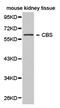 Cystathionine-Beta-Synthase antibody, PA5-76031, Invitrogen Antibodies, Western Blot image 