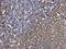 Spleen Associated Tyrosine Kinase antibody, PA5-27262, Invitrogen Antibodies, Immunohistochemistry paraffin image 