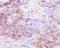 Immunoglobulin Heavy Constant Gamma 4 (G4m Marker) antibody, M11385-1, Boster Biological Technology, Immunohistochemistry paraffin image 